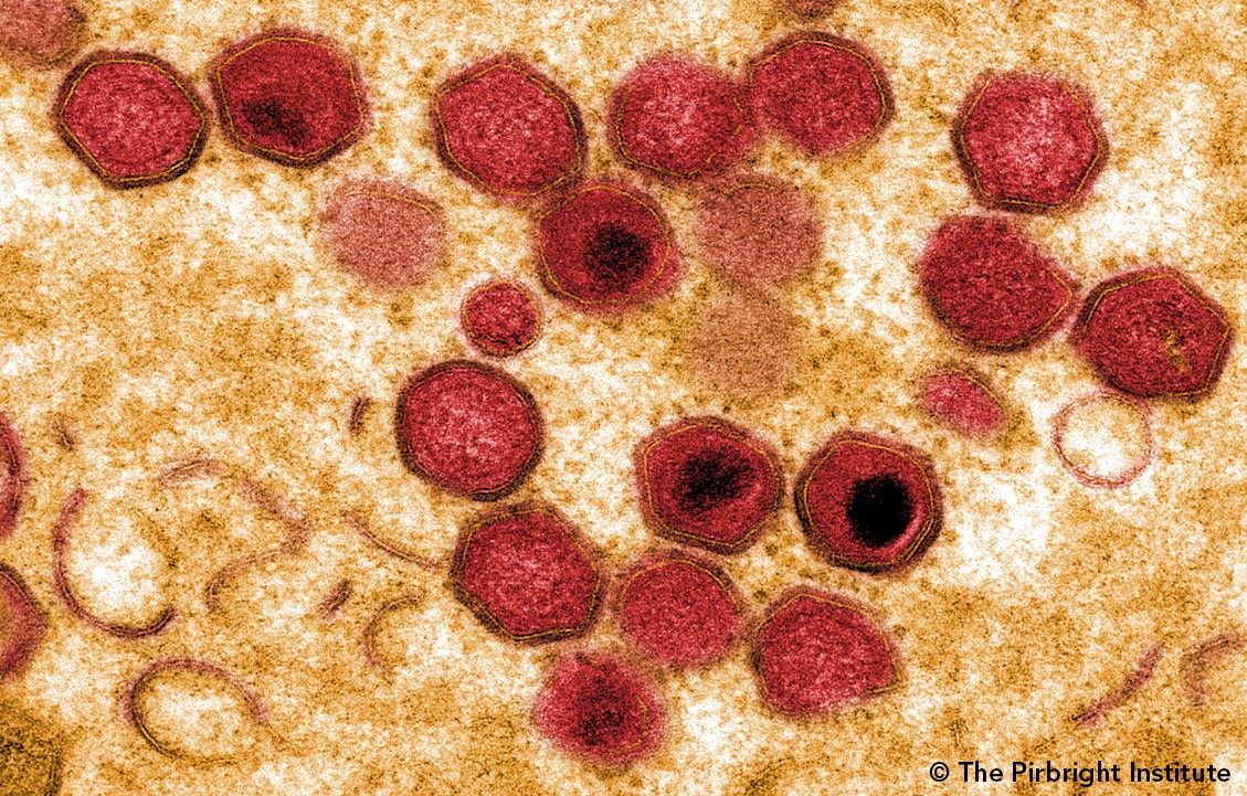 Virus gây bệnh dịch tả heo châu Phi: Đặc điểm, cơ chế lây lan và cách phòng ngừa hiệu quả